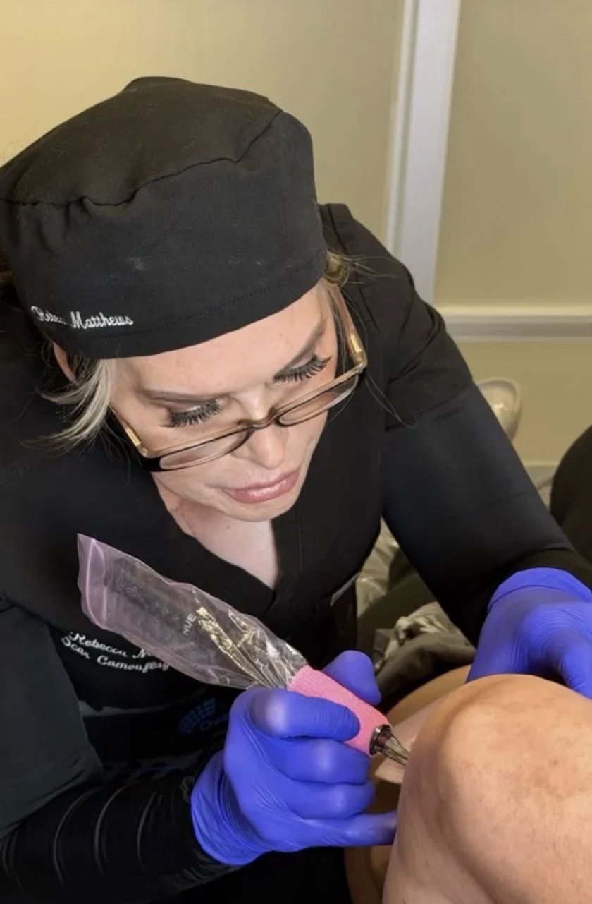 Rebecca Matthews, master certified paramedical artist, performing scar camouflage treatment in her Bakersfield studio